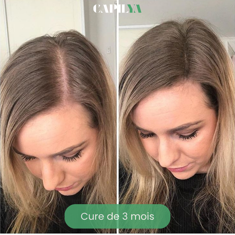 Huile essentielle de Romarin - Stimulant capillaire naturel - Booste la repousse des cheveux