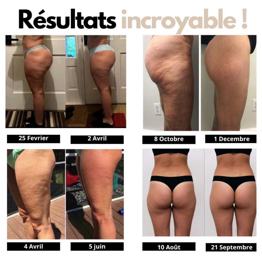 Legging Sculptant - Anti-Cellulite capilya