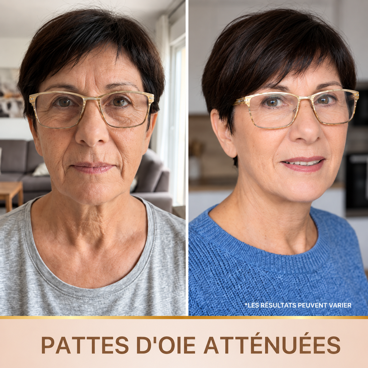 Capilya Pro — Réduit ronflements & apnée du sommeil Capilya