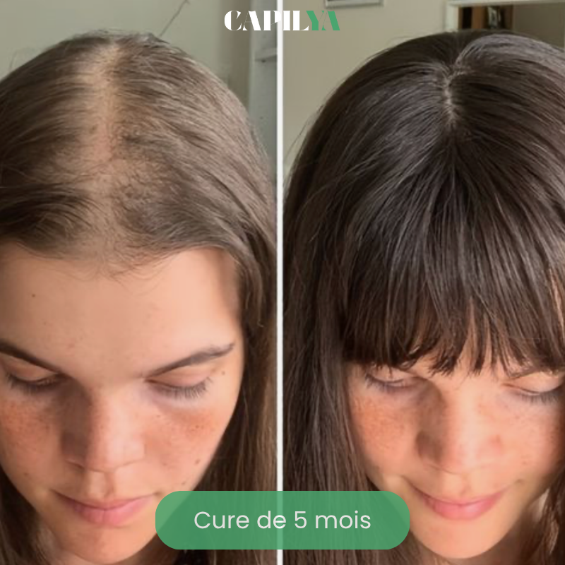 Huile essentielle de Romarin - Stimulant capillaire naturel - Booste la repousse des cheveux