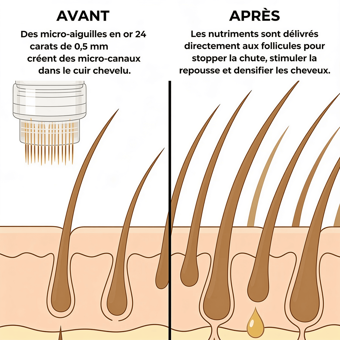 Technologie Capillaire Micro-infuse Homme Léa Skin